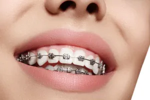 Orthodontist