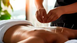 Acupuncturist
