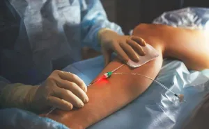 Vascular Surgeon