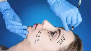 Plastic Surgeons