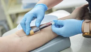 Hematologist