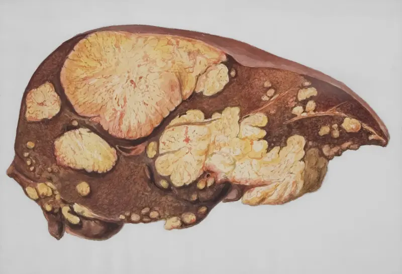 Listening to Your Liver: How Everyday Sounds Shape Organ Wellness - Your Health Directory
