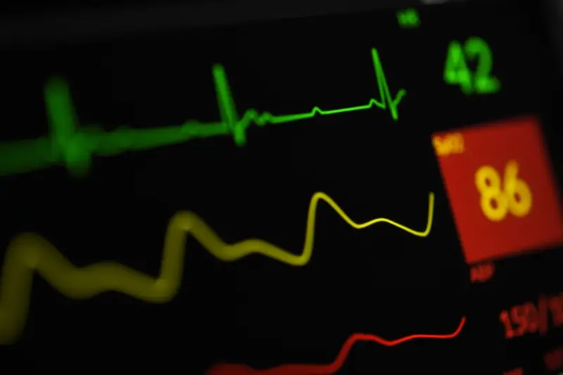 Reframe Your Blood Pressure: A Story‑Driven Blueprint for Sustainable Control