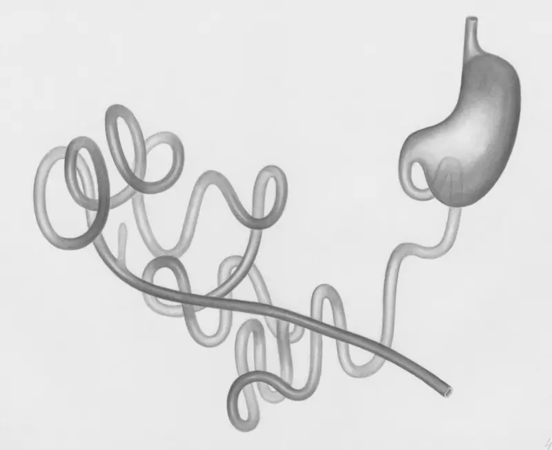 Unlocking the Gut‑Liver Connection: Simple Steps for a Happier, Healthier Liver Unlocking the Gut‑Liver Connection: Simple Steps for a Happier, Healthier Liver