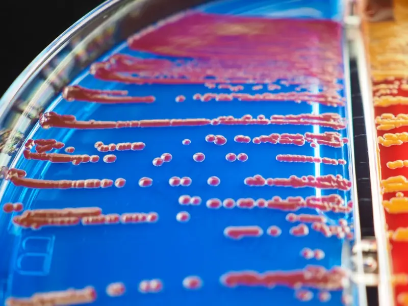 The Gut‑Brain‑Sugar Connection: Rewire Your Microbiome for Stable Glucose The Gut‑Brain‑Sugar Connection: Rewire Your Microbiome for Stable Glucose